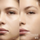 YVES SAINT LAURENT Eclat Touch - All Skin Types